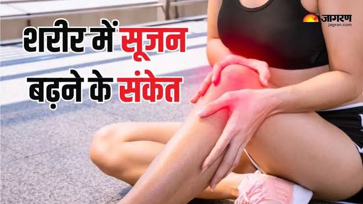 शरीर की सूजन के प्रबन्धन के लिए कुछ प्रमुख होम्योपैथिक दवाएं